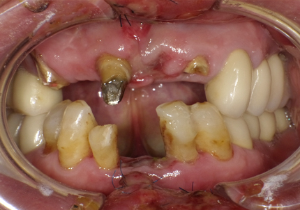 画像に alt 属性が指定されていません。ファイル名: 2-2-1.jpg