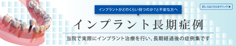 インプラント長期症例　当院で実際にインプラント治療を行い、長期経過後の症例集です