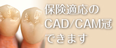保険でCAD/CAM冠