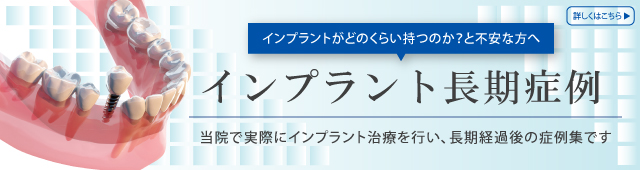 インプラント長期症例　当院で実際にインプラント治療を行い、長期経過後の症例集です