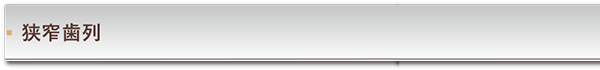 狭窄歯列