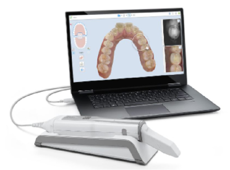 口腔内スキャナー　ポータブル