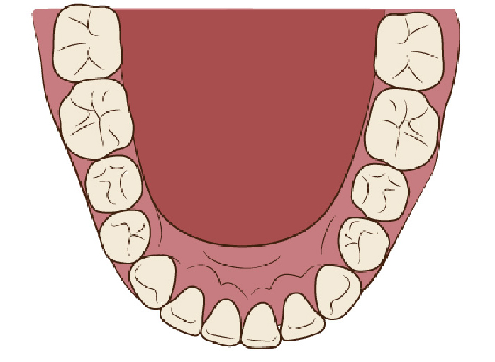 口呼吸者の口の中